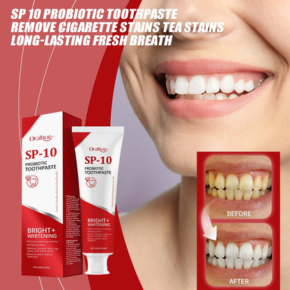 SP 10 Probiotic Toothpaste for Stain Removal and Fresh Breath - 120g